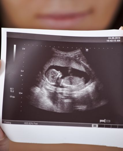 fotografija ultrazvoka